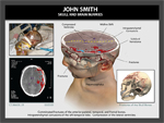 Click to enlarge: John Smith: Brain and Skull Injuries